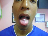 /album/galeria-de-piercings/imagem-007-jpg/